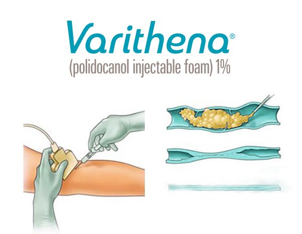 Varithena